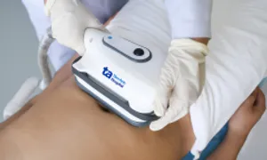 Giảm cân bằng công nghệ đông hủy mỡ thế nào? Giảm cân bằng công nghệ đông hủy mỡ thế nào?
