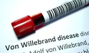 Von Willebrand - bệnh gây chảy máu kéo dài Von Willebrand - bệnh gây chảy máu kéo dài