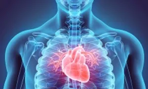 Ai dễ bị nhồi máu cơ tim? Ai dễ bị nhồi máu cơ tim?
