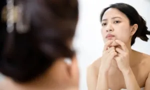 Nặn mụn có nguy cơ mắc uốn ván không? Nặn mụn có nguy cơ mắc uốn ván không?