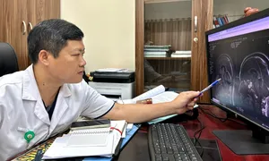 Vừa nội soi qua mũi vừa mở hộp sọ loại bỏ khối u não Vừa nội soi qua mũi vừa mở hộp sọ loại bỏ khối u não