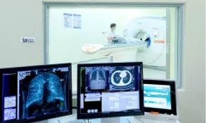 Các thời điểm nên tầm soát ung thư phổi